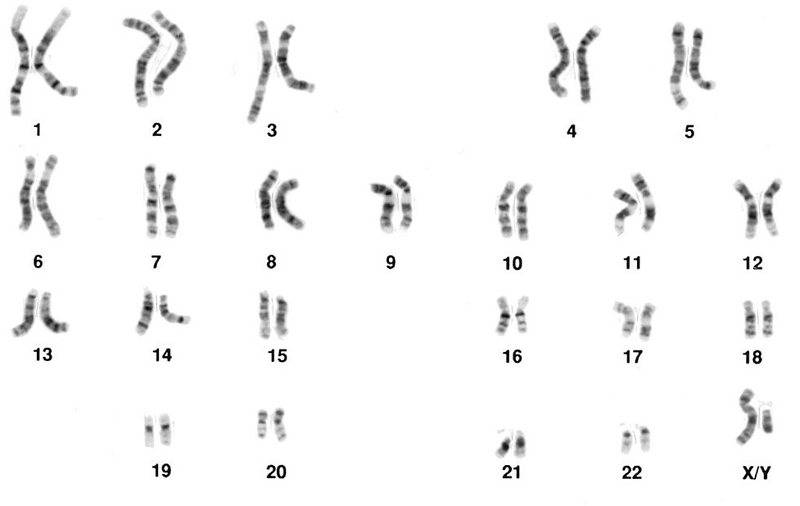 Illustration for article titled What Made the Y Chromosome So Tiny?